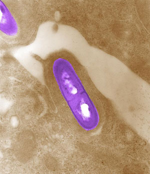 Listeria cells
