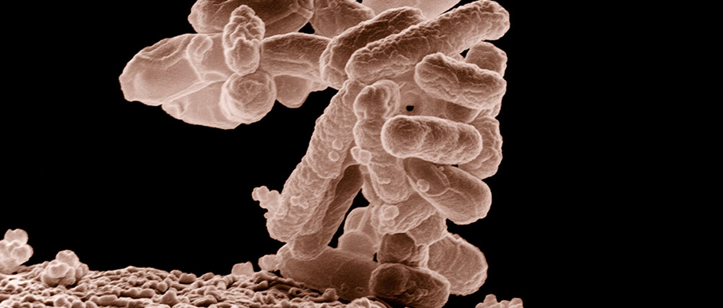 e. coli